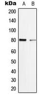 MAPT / Tau Antibody (phospho-Ser713)