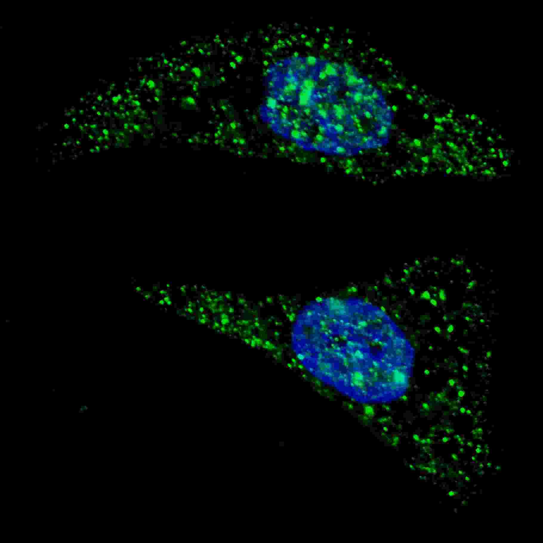 IHC-plus™ Polyclonal Rabbit anti-Human APG5 / ATG5 Antibody (aa1-30, IHC, IF, WB)