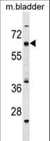 CECR6 Antibody (aa504-531)