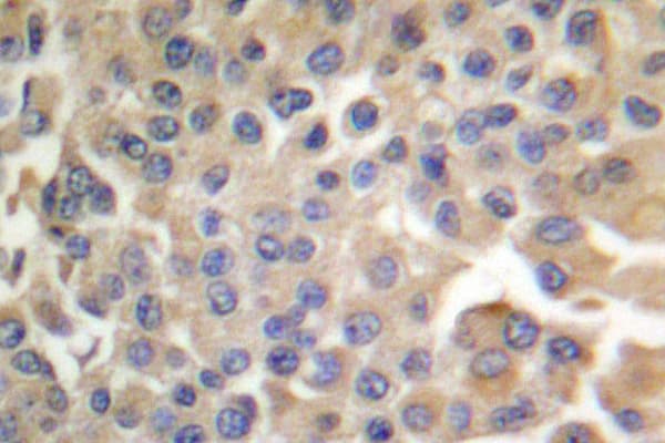 SYN / FYN Antibody (phospho-Tyr530)