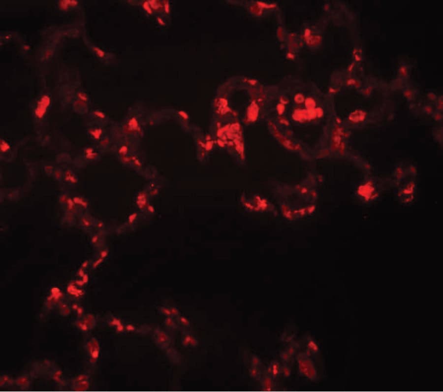 IHC-plus™ Polyclonal Rabbit anti-Human MRE11A / MRE11 Antibody (IHC, IF, WB)