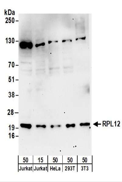 Polyclonal Rabbit anti-Human RPL12 / Ribosomal Protein L12 Antibody (aa115-165, WB)