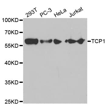IHC-plus™ TCP1 Antibody