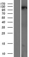 ZNF295 Protein (Over-Expression Lysate Myc-DDK (Flag))