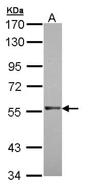 Polyclonal Rabbit anti-Human RAG2 / RAG-2 Antibody (aa271-527, IHC, WB)