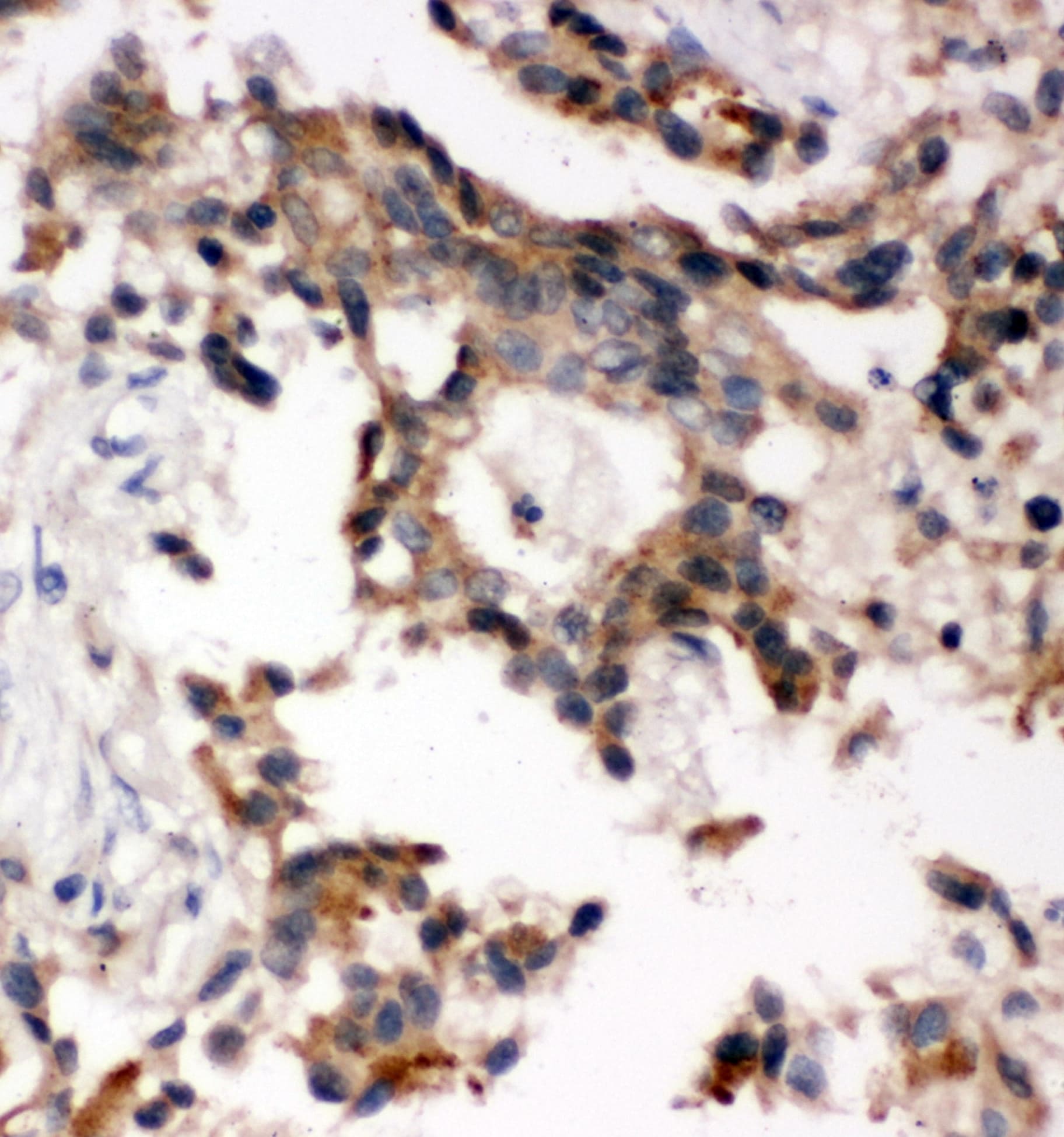 Polyclonal Rabbit anti-Human ABI1 / SSH3BP1 Antibody (aa483-494, IHC, WB)