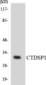 IHC-plus™ Polyclonal Rabbit anti-Human CTDSP1 / SCP1 Antibody (aa22-71, IHC, WB)