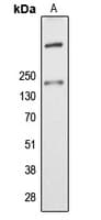 ALMS1 Antibody (Internal)