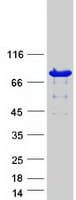 Human PAD2 / PADI2 Protein (Recombinant Myc-DDK (Flag))