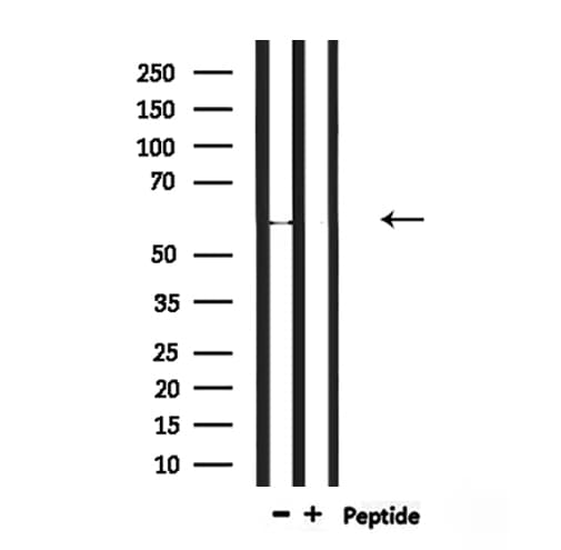 Polyclonal Rabbit anti-Human RBPJL Antibody (WB)