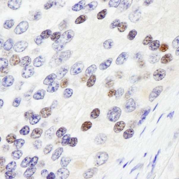 Polyclonal Rabbit anti-Human ZHX3 Antibody (aa906-956, IHC, WB)