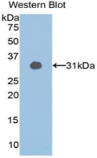SIRT1 / Sirtuin 1 Antibody (aa244-498, clone C4, PE)