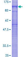 Human RHPN2 Protein (Recombinant GST)