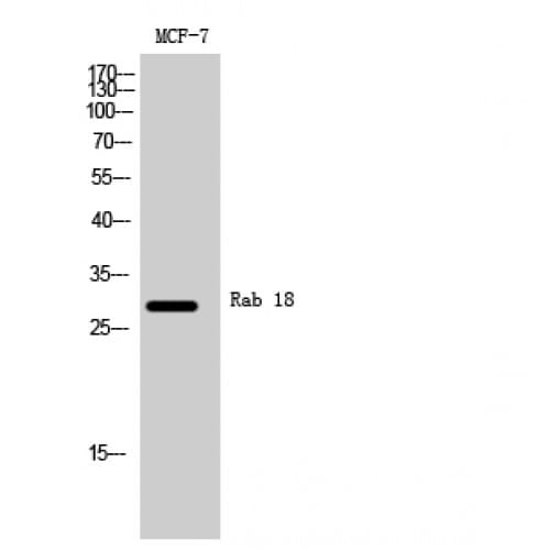 Polyclonal Rabbit anti-Human RAB18 Antibody (80-160 aa, Internal, WB)
