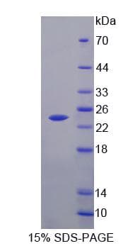 Mouse FLRT1 Protein (Recombinant His, N-Terminal)