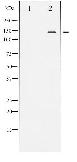 Polyclonal Rabbit anti-Human NOS3 / eNOS Antibody (phospho-Ser1177, IHC, IF, WB)