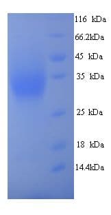 Human METRNL Protein (Recombinant His)