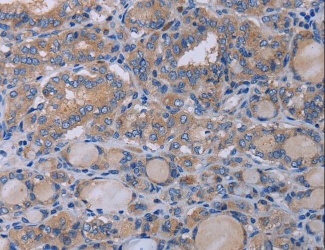 P2RX3 / P2X3 Antibody