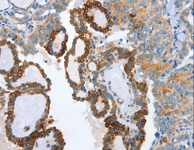 Polyclonal Rabbit anti-Human ARA9 / AIP Antibody (IHC)