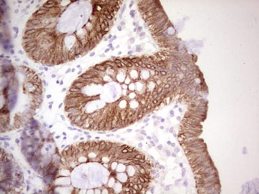 ABCB1 / MDR1 / P Glycoprotein Antibody (aa995-1280, clone OTI8A9)