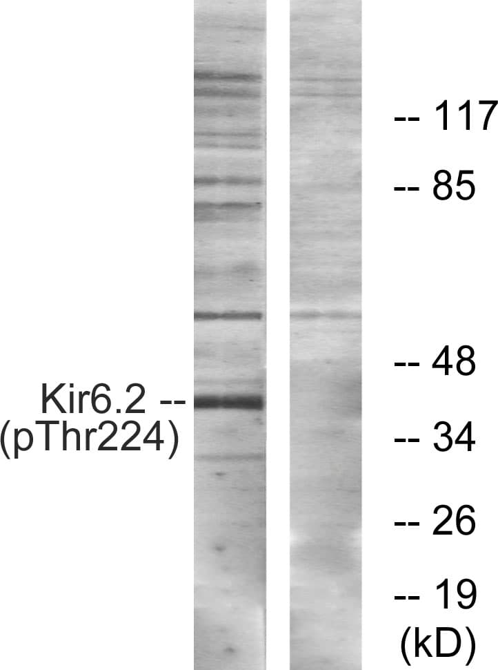 KCNJ11 / Kir6.2 Antibody (phospho-Thr224)