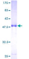 Human RAB17 Protein (Recombinant GST)