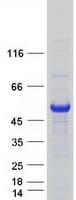 Human EIF2B3 Protein (Recombinant Myc-DDK (Flag))