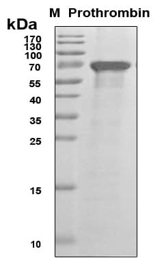 Human F2 / Prothrombin / Thrombin Protein (Recombinant 6His, N-terminus)