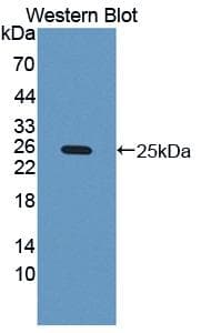 CSF3 / G-CSF Antibody (aa38-195, Biotin)