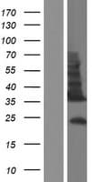 TMEM54 Protein (Over-Expression Lysate Myc-DDK (Flag))