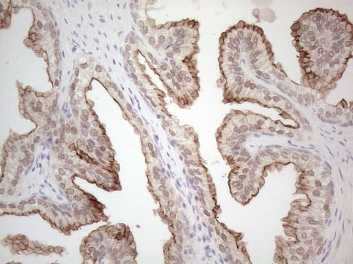 ABCC5 / MRP5 Antibody (clone OTI2C8)
