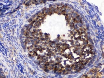 CCT5 / TCP1 Epsilon Antibody