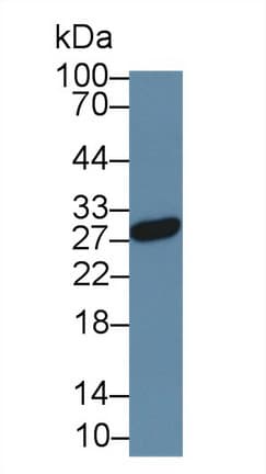 NOG / Noggin Antibody (APC)
