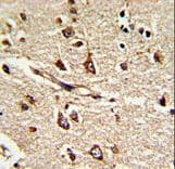 PDIA6 / ERP5 Antibody (aa144-172)