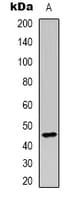 CD209 / DC-SIGN Antibody (Internal)