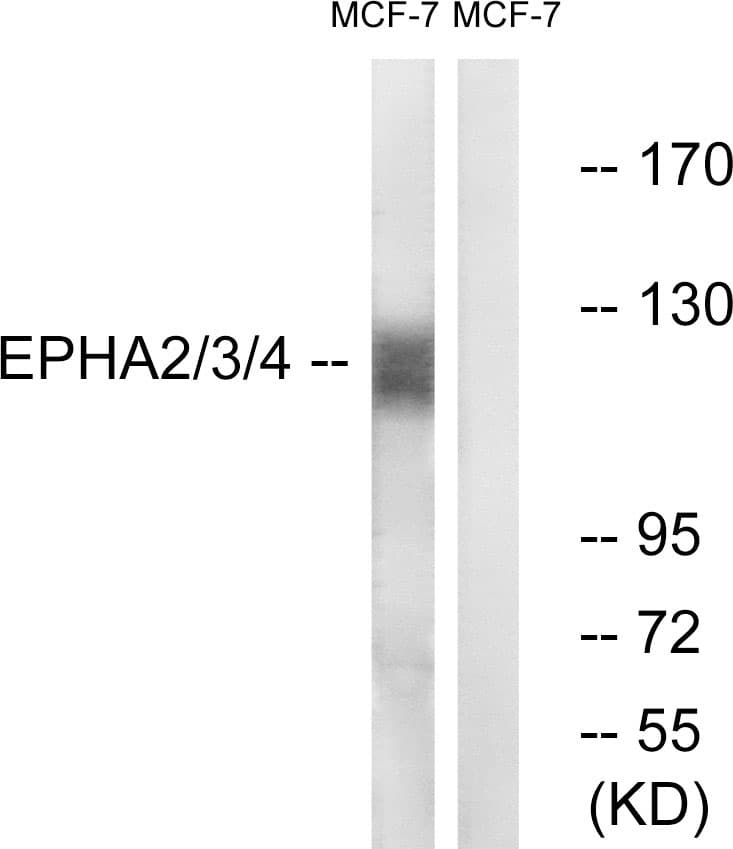 Polyclonal Rabbit anti-Human EPH Receptor A2+A3+A4 Antibody (Internal, IF, WB)