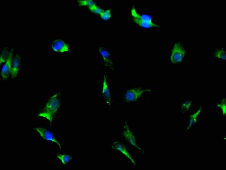 Polyclonal Rabbit anti-Human PGAM5 Antibody (IHC, IF)