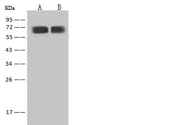 Polyclonal Rabbit anti-Human UBQLN4 Antibody (WB)