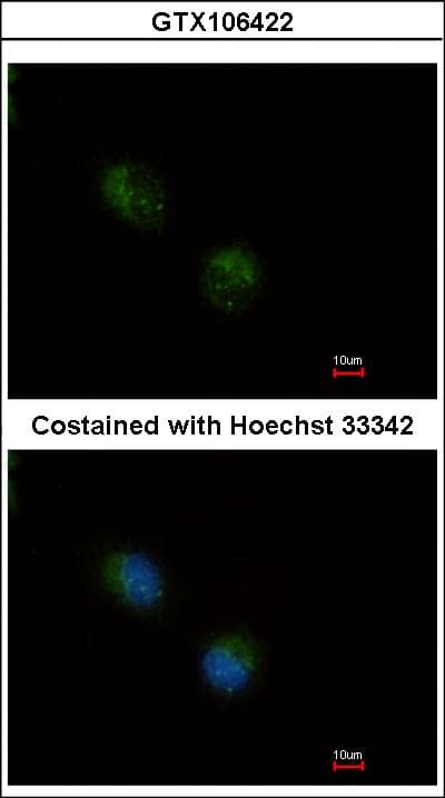 SCG10 / STMN2 Antibody (aa2-41)