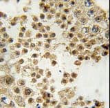 ACE2 / ACE-2 Antibody (aa59-90)