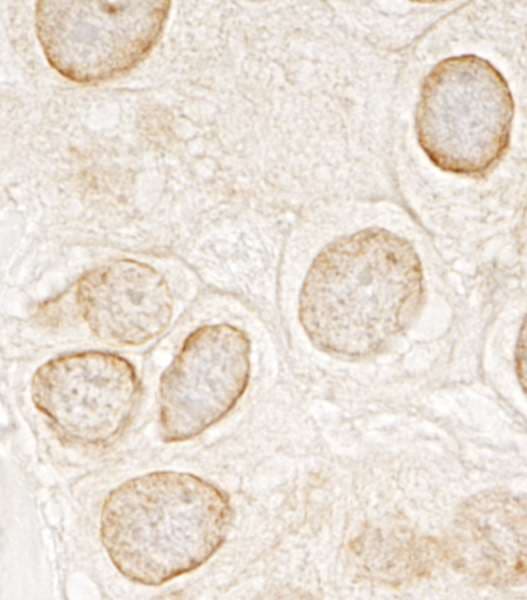 TOR1AIP1 / LAP1 Antibody (aa275-325)