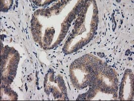ACOT12 Antibody (clone OTI1B9)