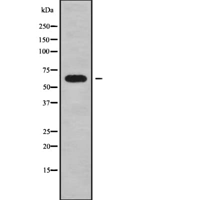 Polyclonal Rabbit anti-Human ORC2L / ORC2 Antibody (IHC, WB)