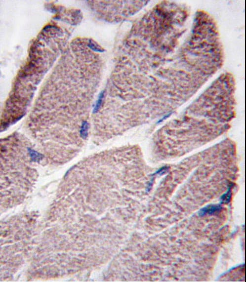 PTPN21 / PTPD1 Antibody (aa751-780)