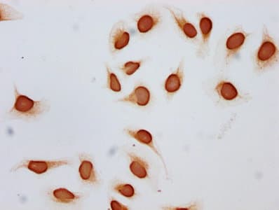 Polyclonal Rabbit anti-Human HIST1H2BN Antibody (IHC, IF, WB)