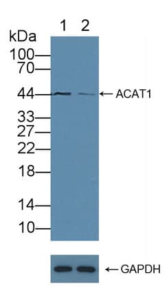 ACAT1 Antibody
