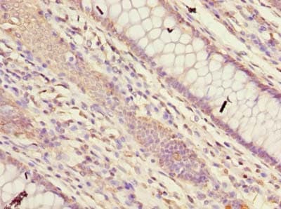 FAM149B1 Antibody