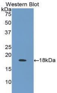 LTBR Antibody (aa66-215)