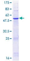 Human NRM Protein (Recombinant GST)