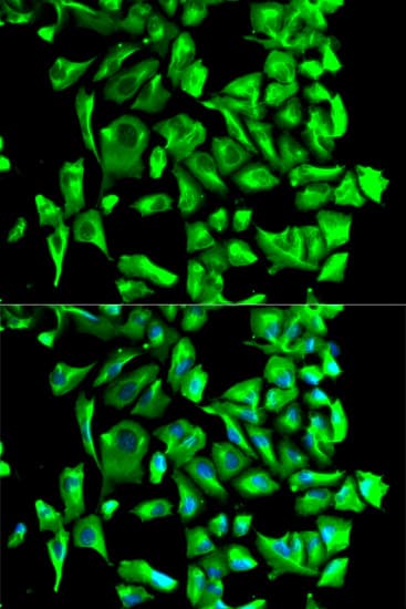 HSP90AB1 / HSP90 Alpha B1 Antibody